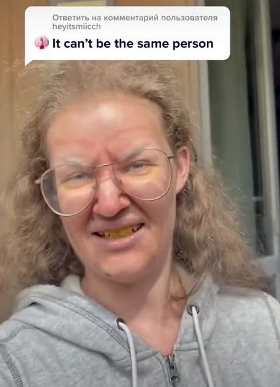  Woman transformation goes viral 