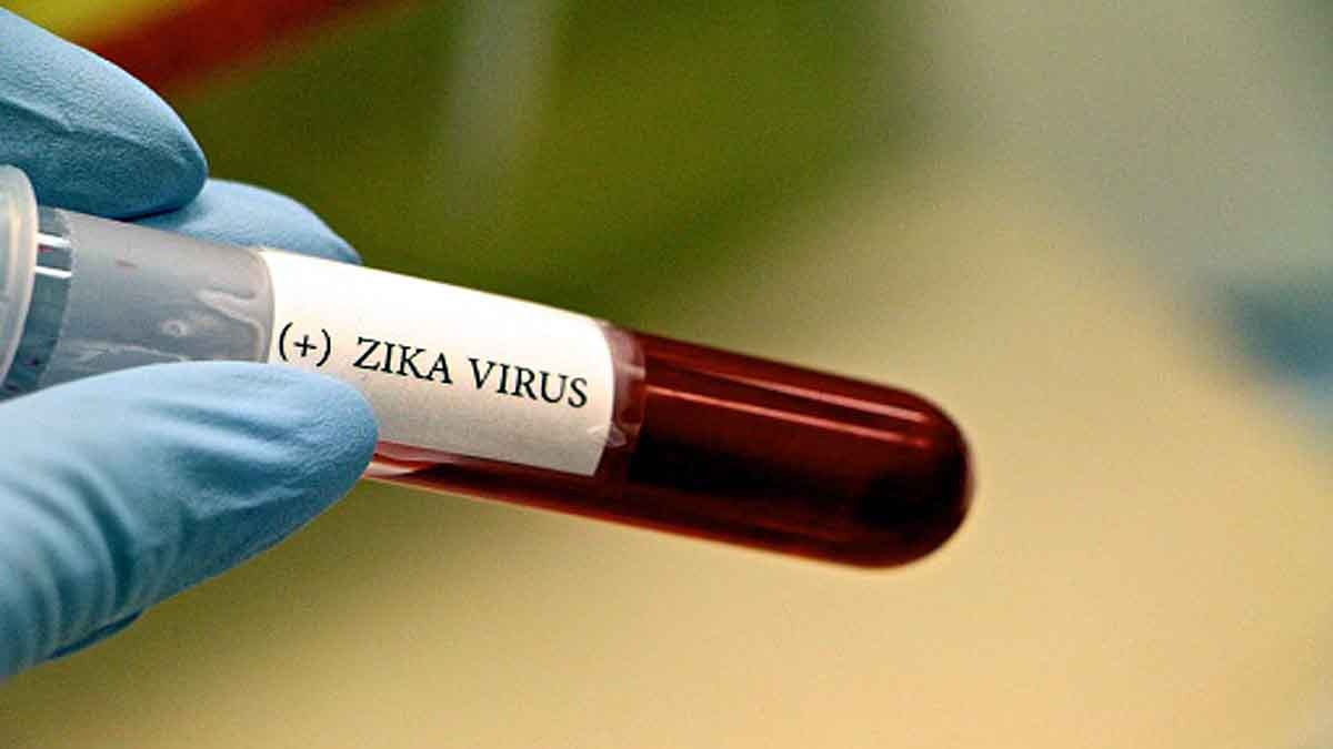 Zika Virus Next Pandemic