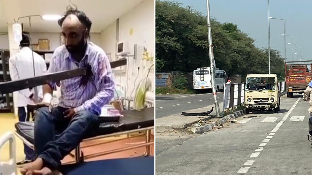 कंधे के आर पार हुई 4 फीट लंबी लोहे की एंगल, डॉक्टरों ने इस तरह बचाई जान