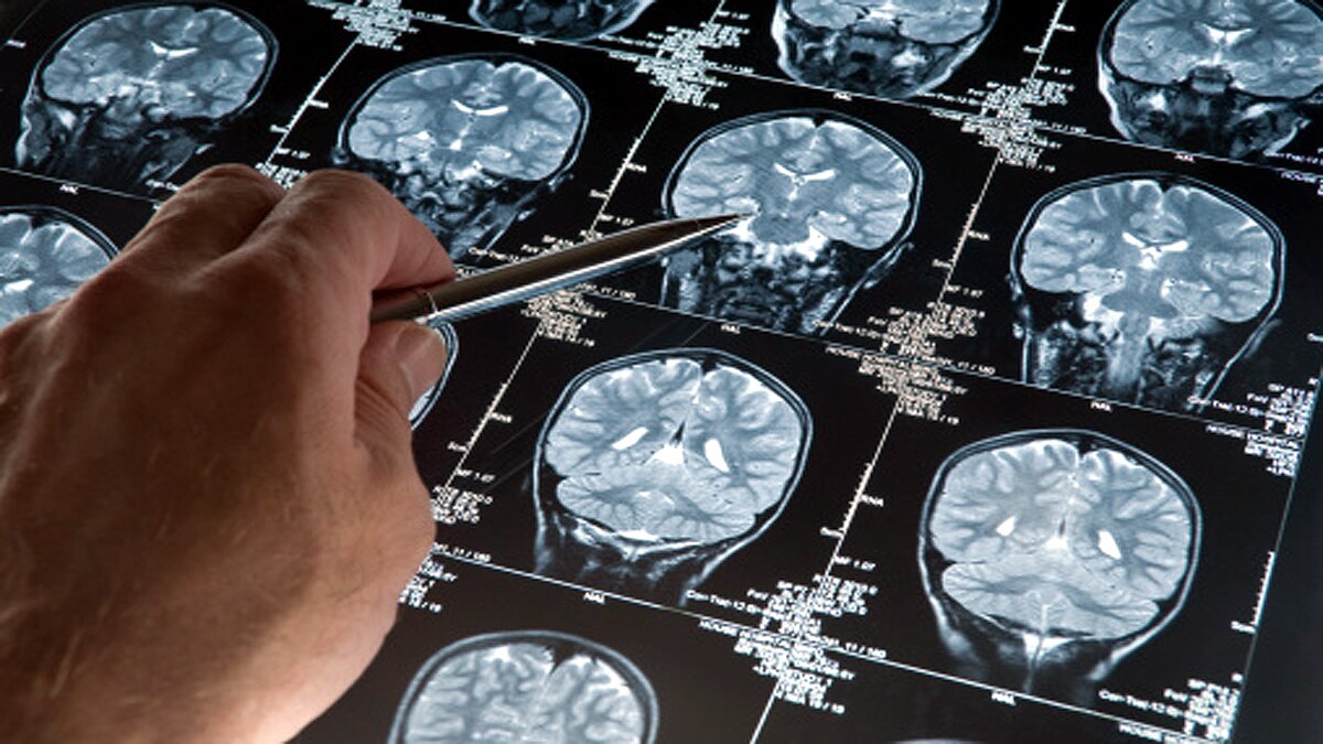 age-related memory loss