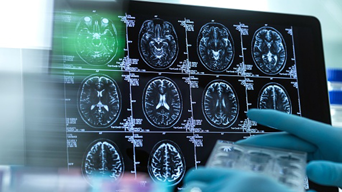 age-related memory loss