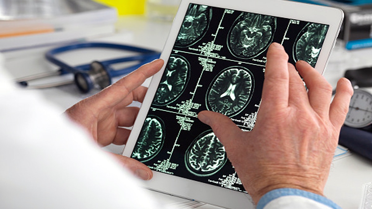 age-related memory loss