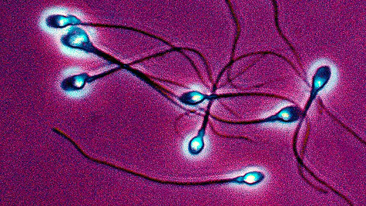 Sperm Hunting Antibodies