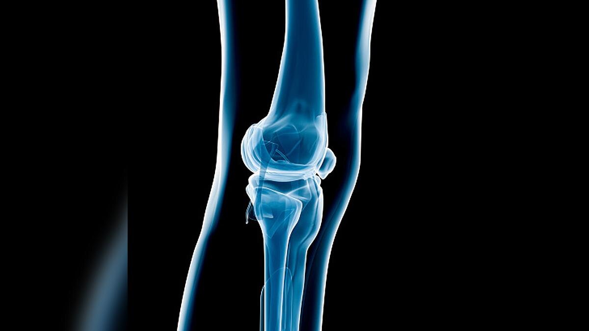 Delhi Doctors bone surgery
