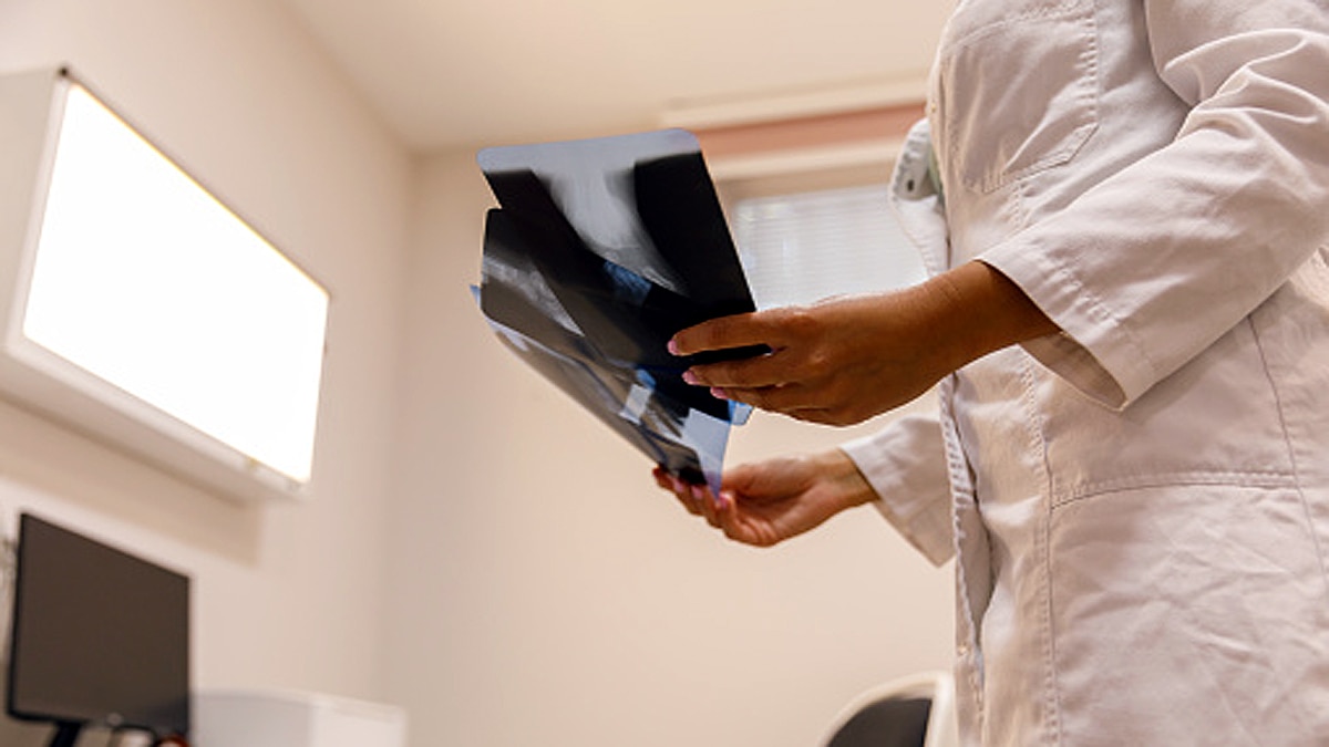 Delhi Doctors bone surgery