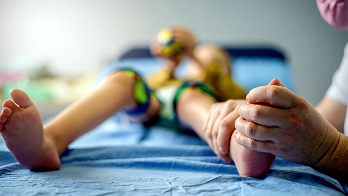 Delhi Doctors bone surgery