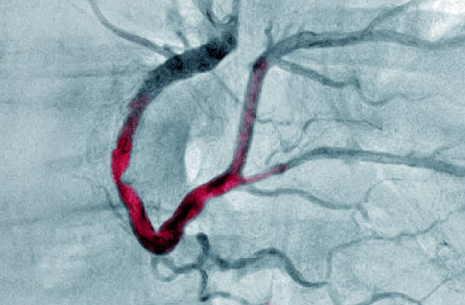 ये 7 लक्षण हैं हाई ब्लड प्रेशर के वॉर्निंग साइन