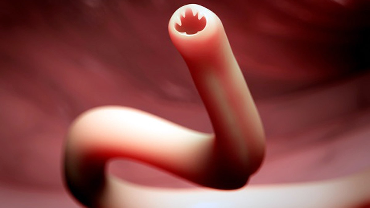 Tapeworm Drugs Covid-19