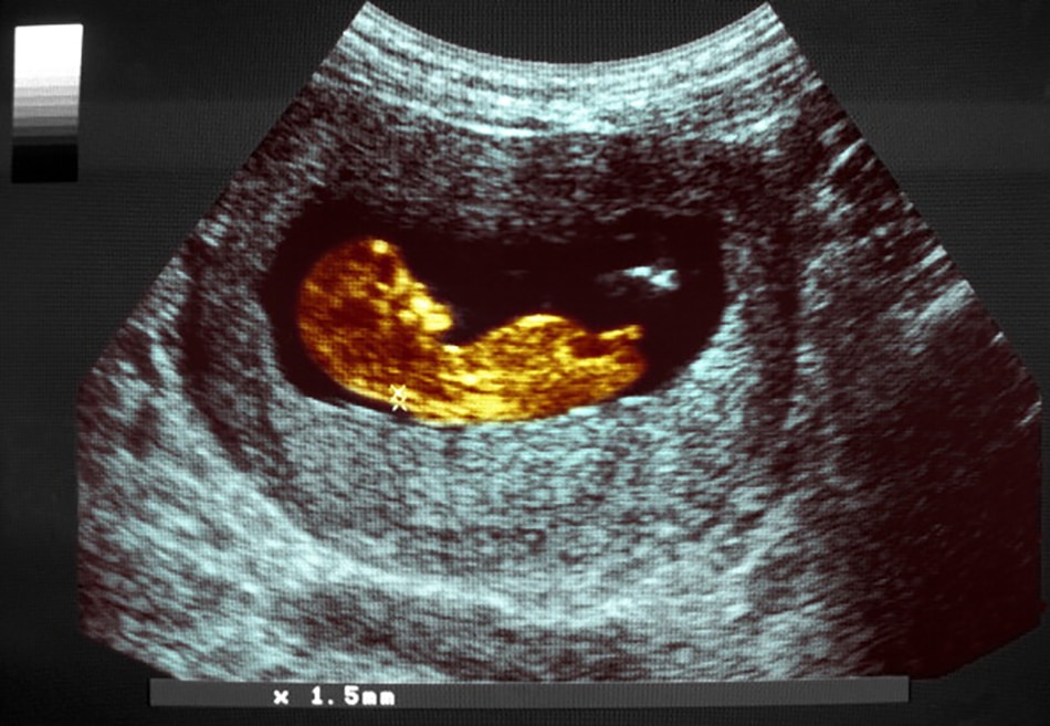 प्रतीकात्मक फोटो (Getty) 