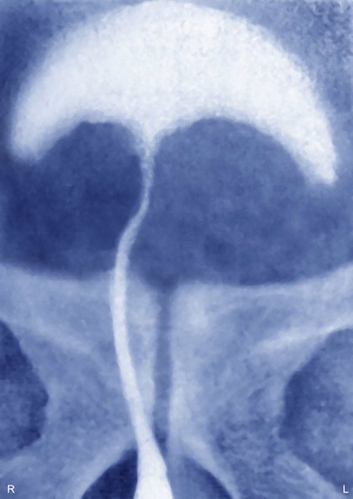 private part surgery