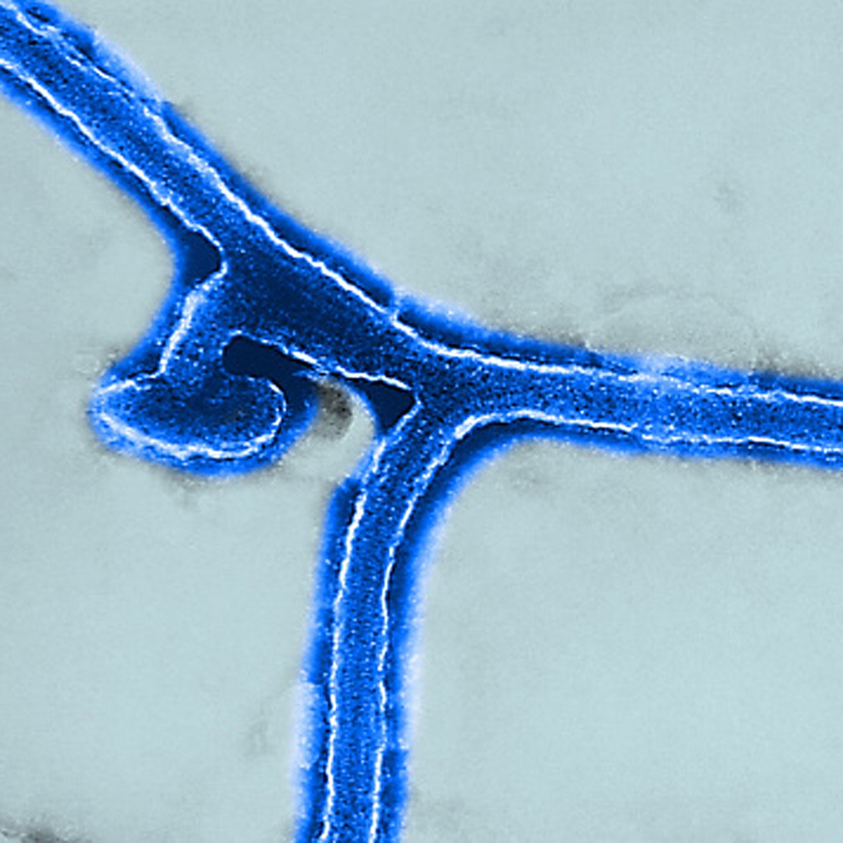 Ebola like virus marburg