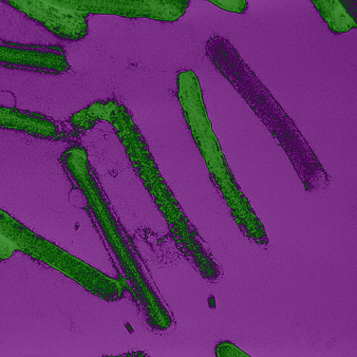 Ebola like virus marburg