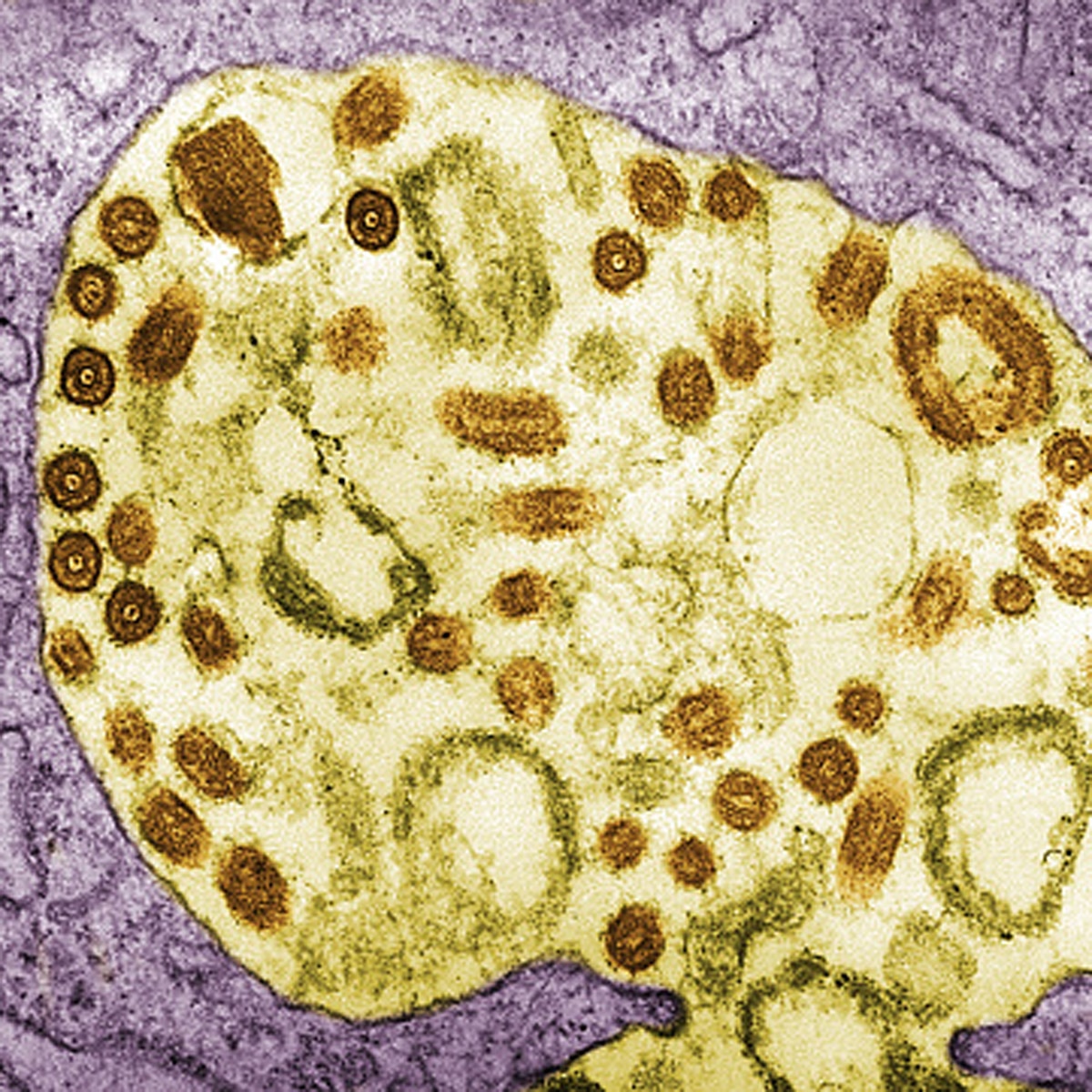 Ebola like virus marburg