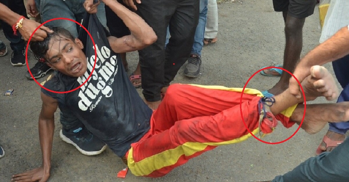 पिटाई करने वालों पर कोई एक्शन नहीं