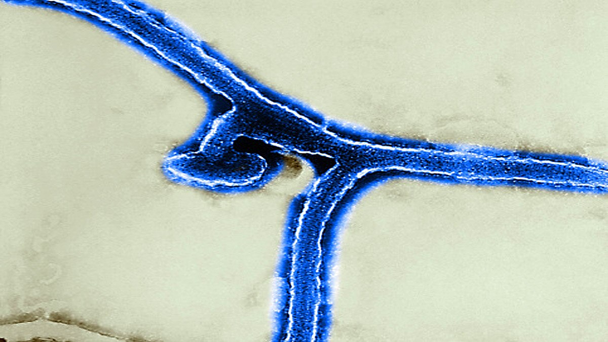 Marburg Virus Guinea Africa