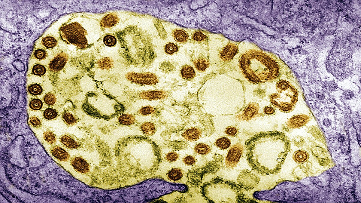 Marburg Virus Guinea Africa