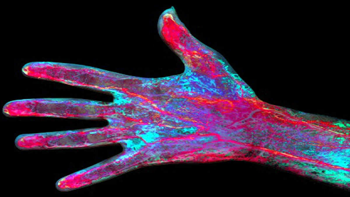 Humans growing Extra Artery
