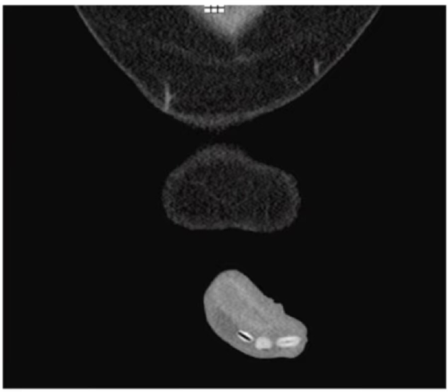 private part surgery