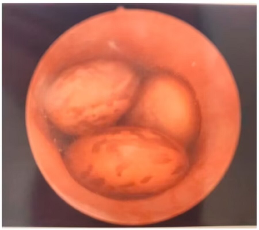 private part surgery