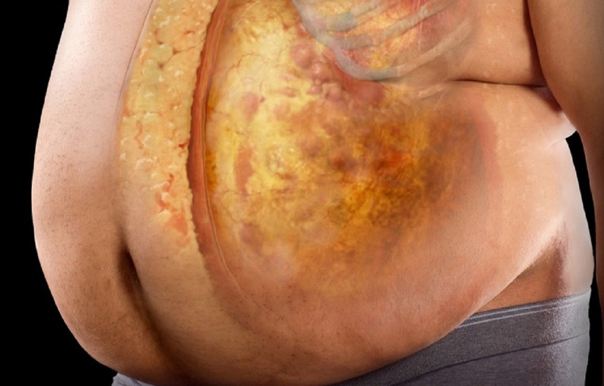 बिना कपड़ों के सोने के फायदे