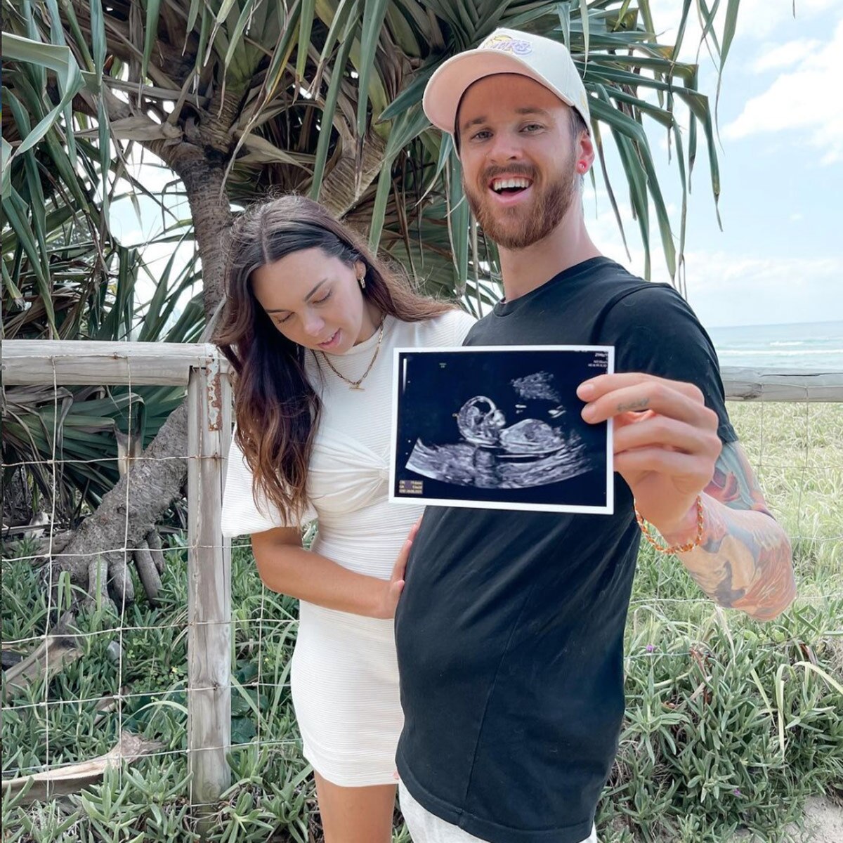 man become 'preganant'