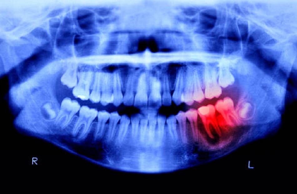 होंठ चबाना घातक बीमारी का संकेत