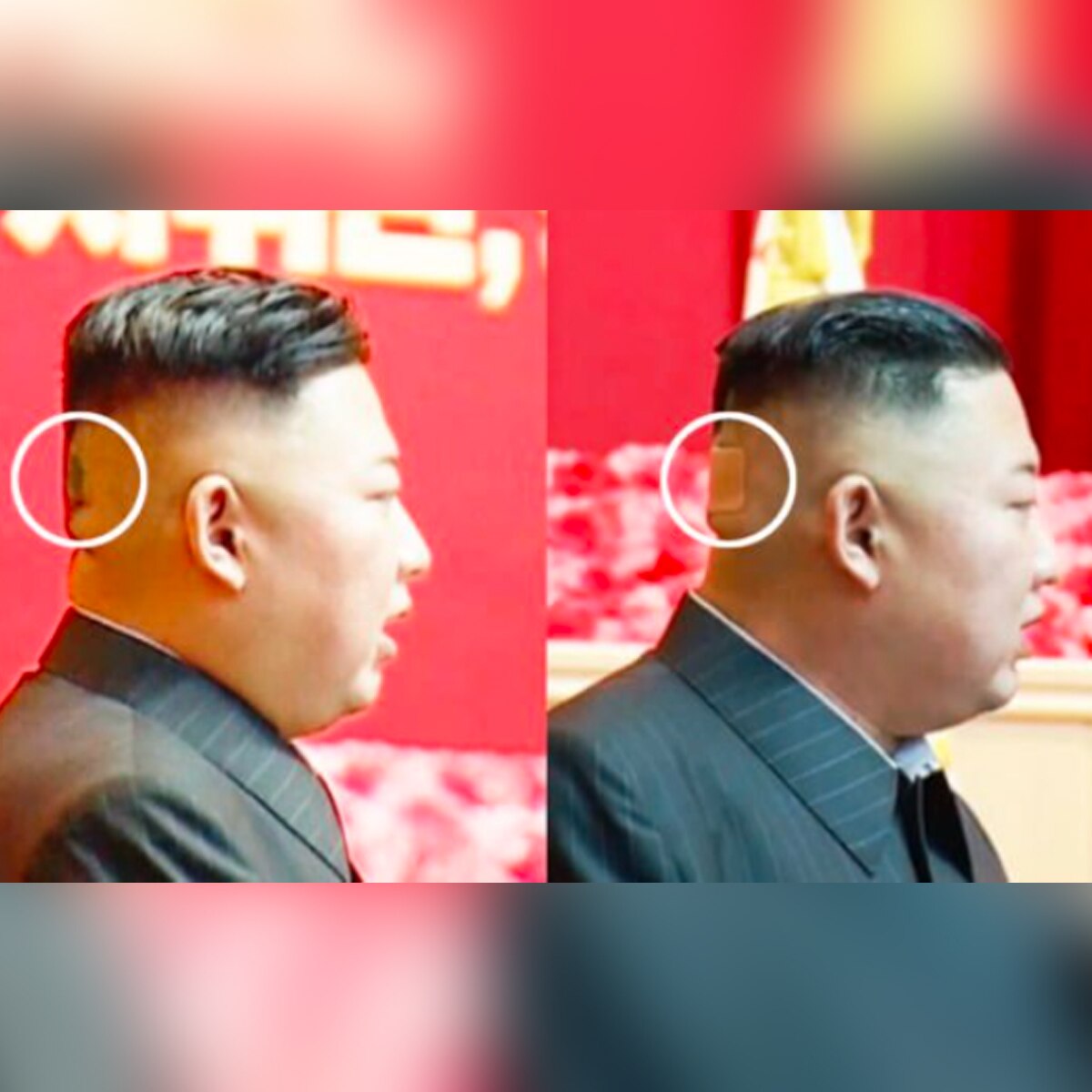 kim jong un health