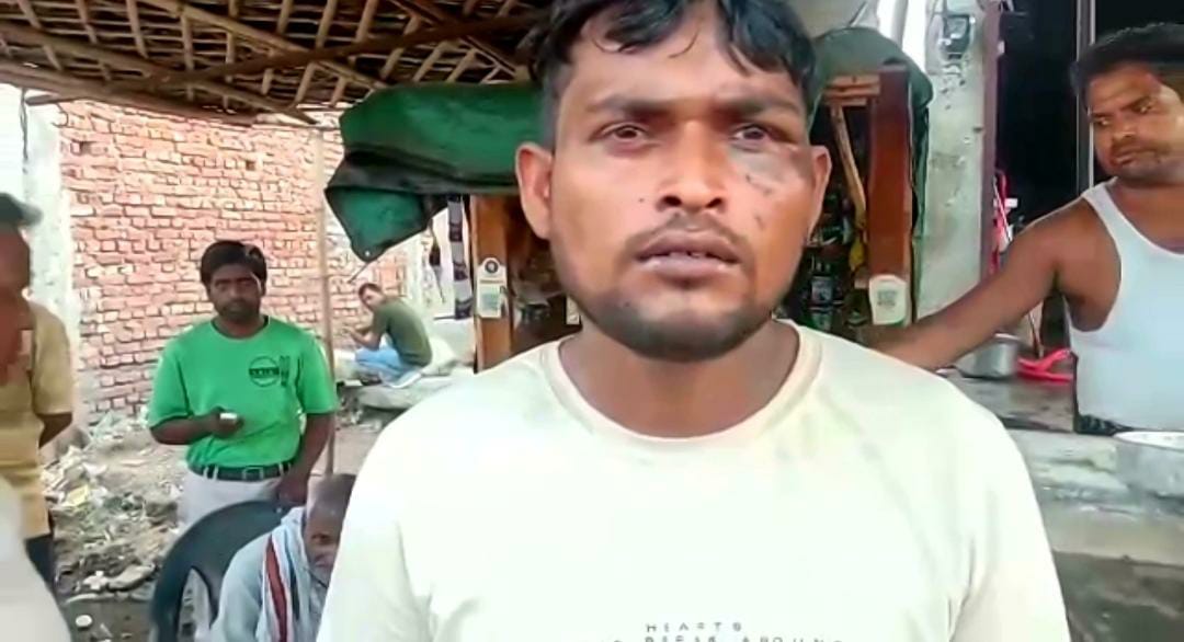 Uncle and nephew beaten up