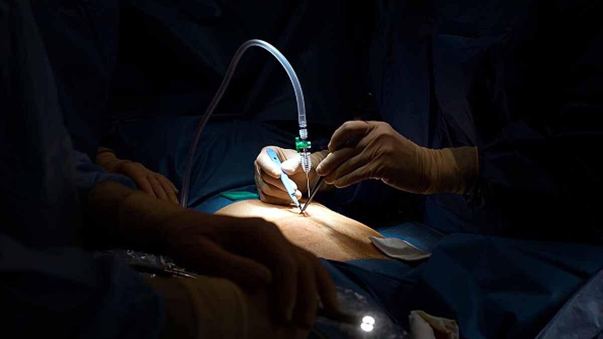 Treatment for endometriosis