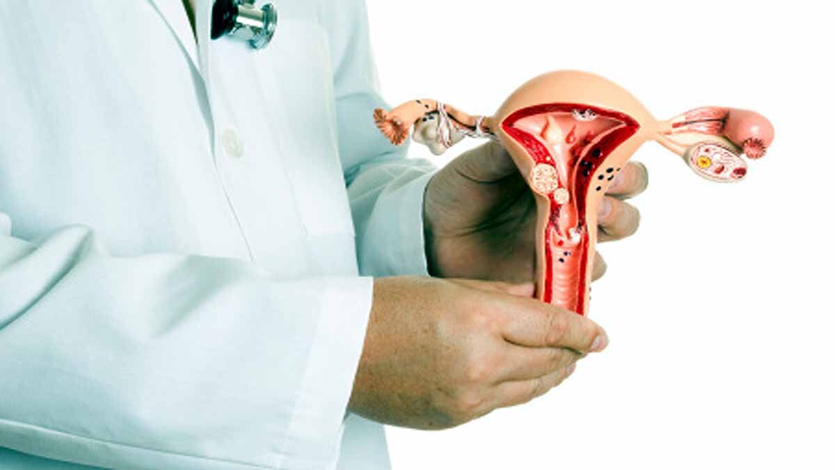 Treatment for endometriosis