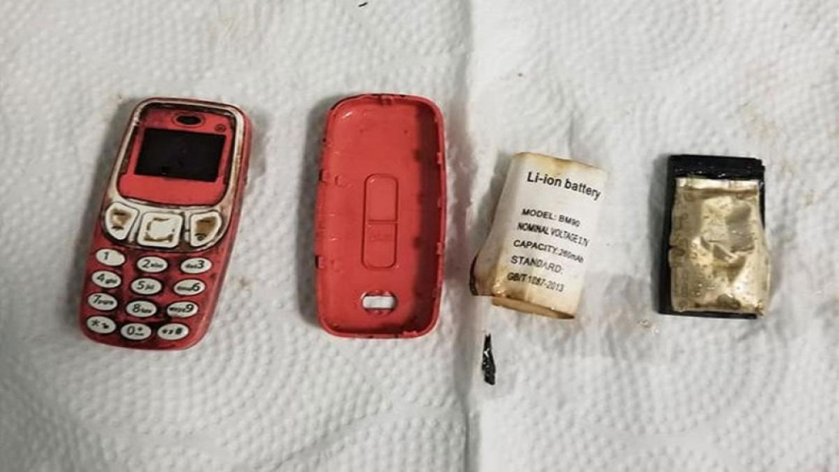 कैदी को पेट में हो रहा था दर्द, एक्स-रे देख डॉक्टर रह गए दंग, शरीर में था मोबाइल फोन