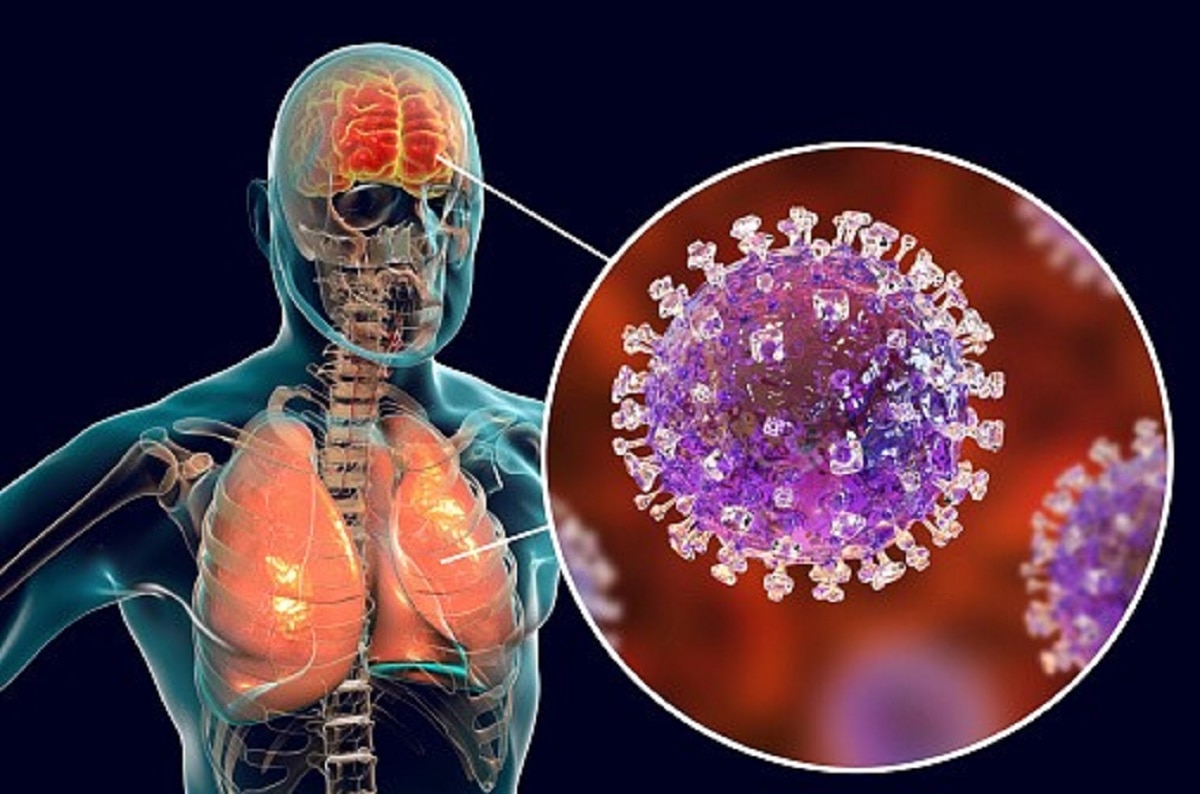 कितना खतरनाक है निपाह वायरस?