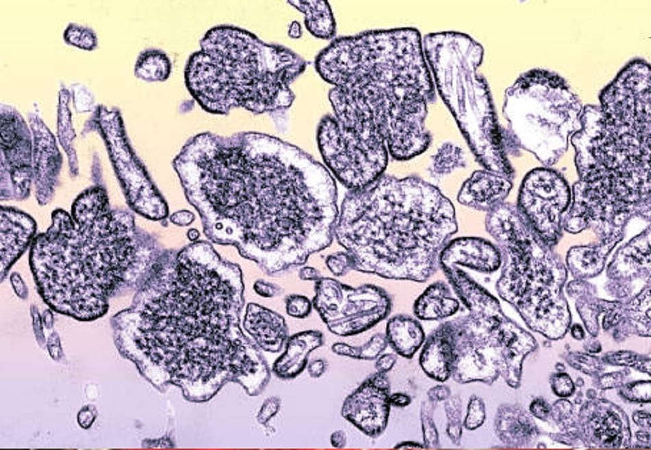 कितना खतरनाक है निपाह वायरस?