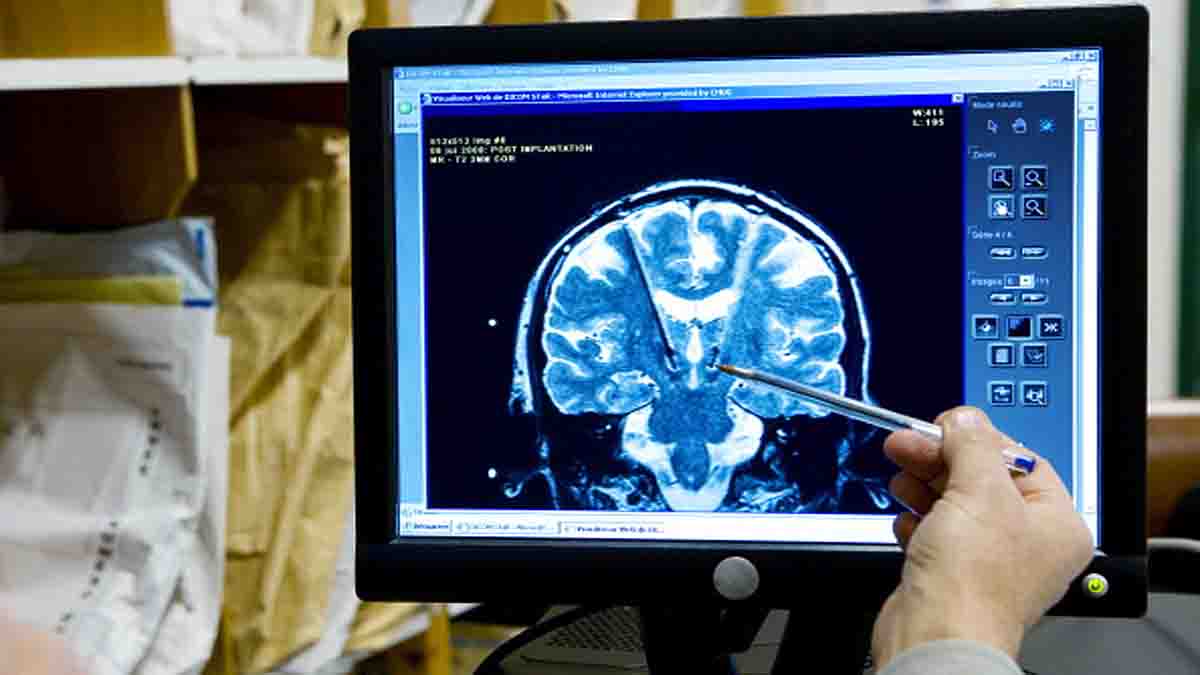 Blind Patient Brain Implant