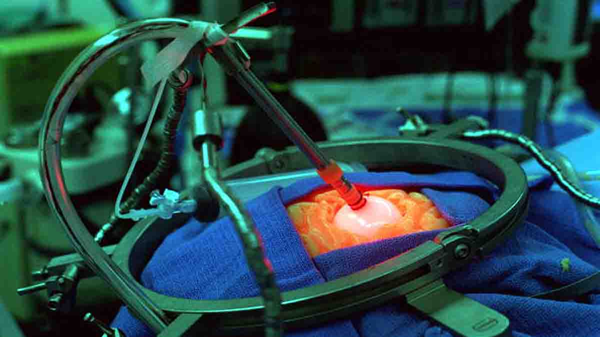 Blind Patient Brain Implant