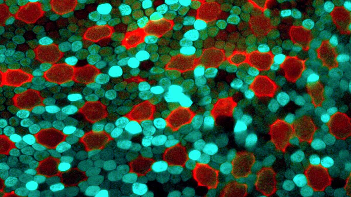 Viruses to Cure Blindness