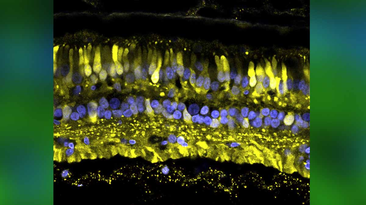 Viruses to Cure Blindness