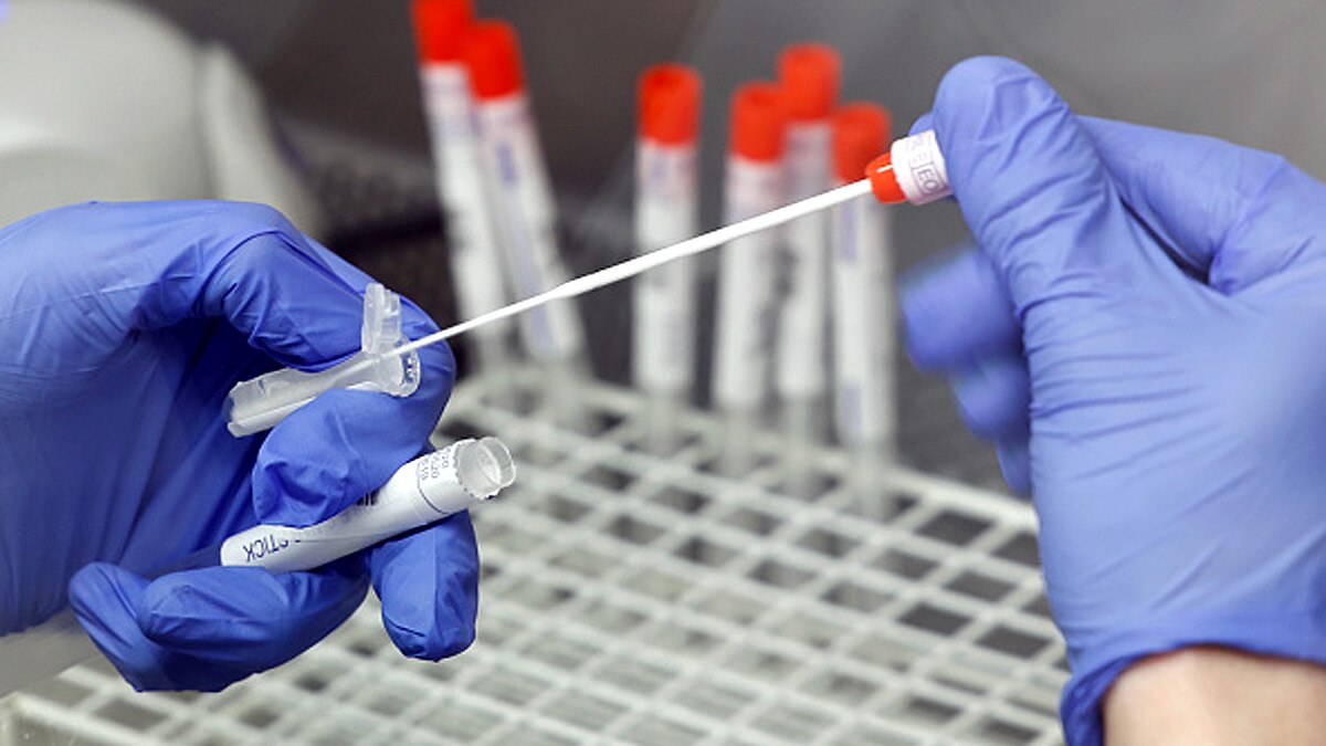 Covid-19 Variant B.1.1.529