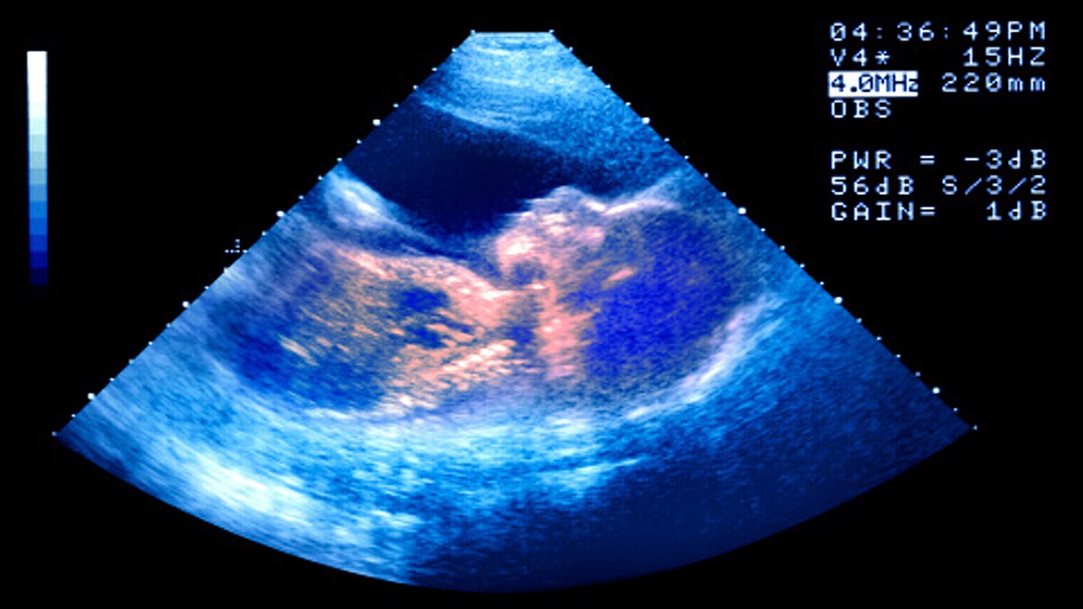 Do Babies cry in womb?