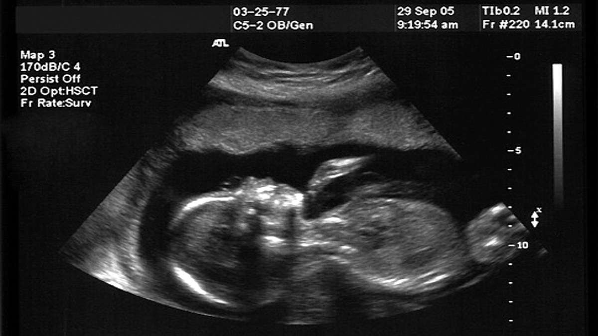 Do Babies cry in womb?