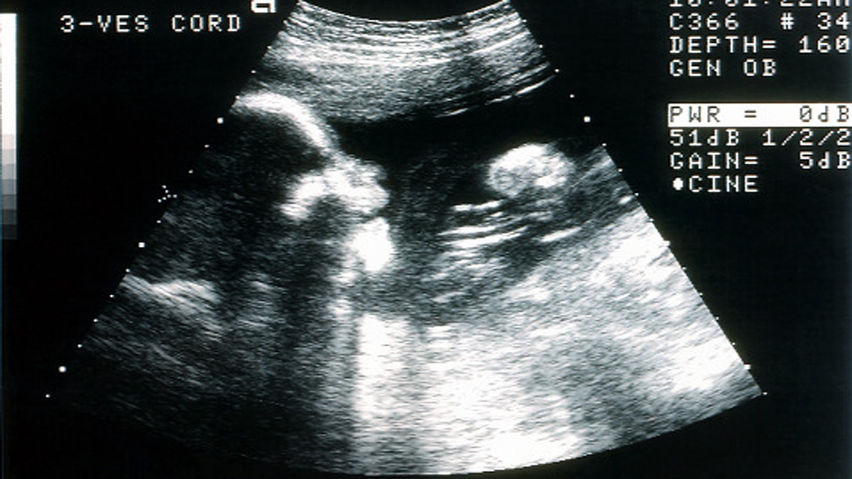 Do Babies cry in womb?