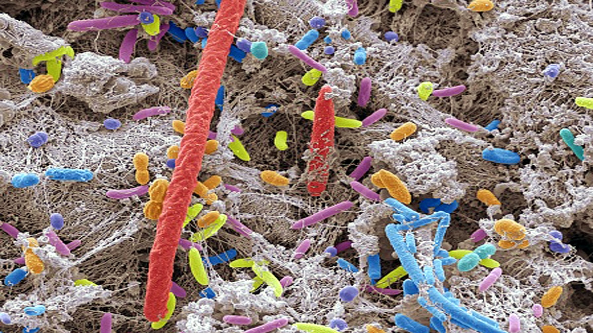 Mysterious brain invading fungus