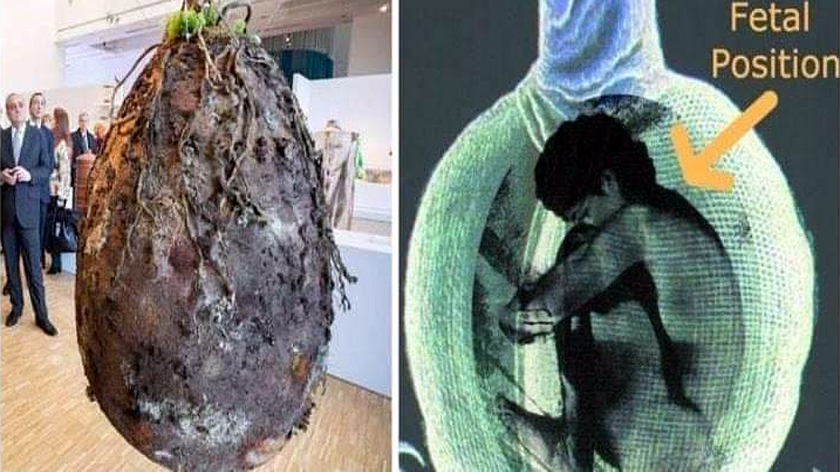 Dead Bodies into Trees 