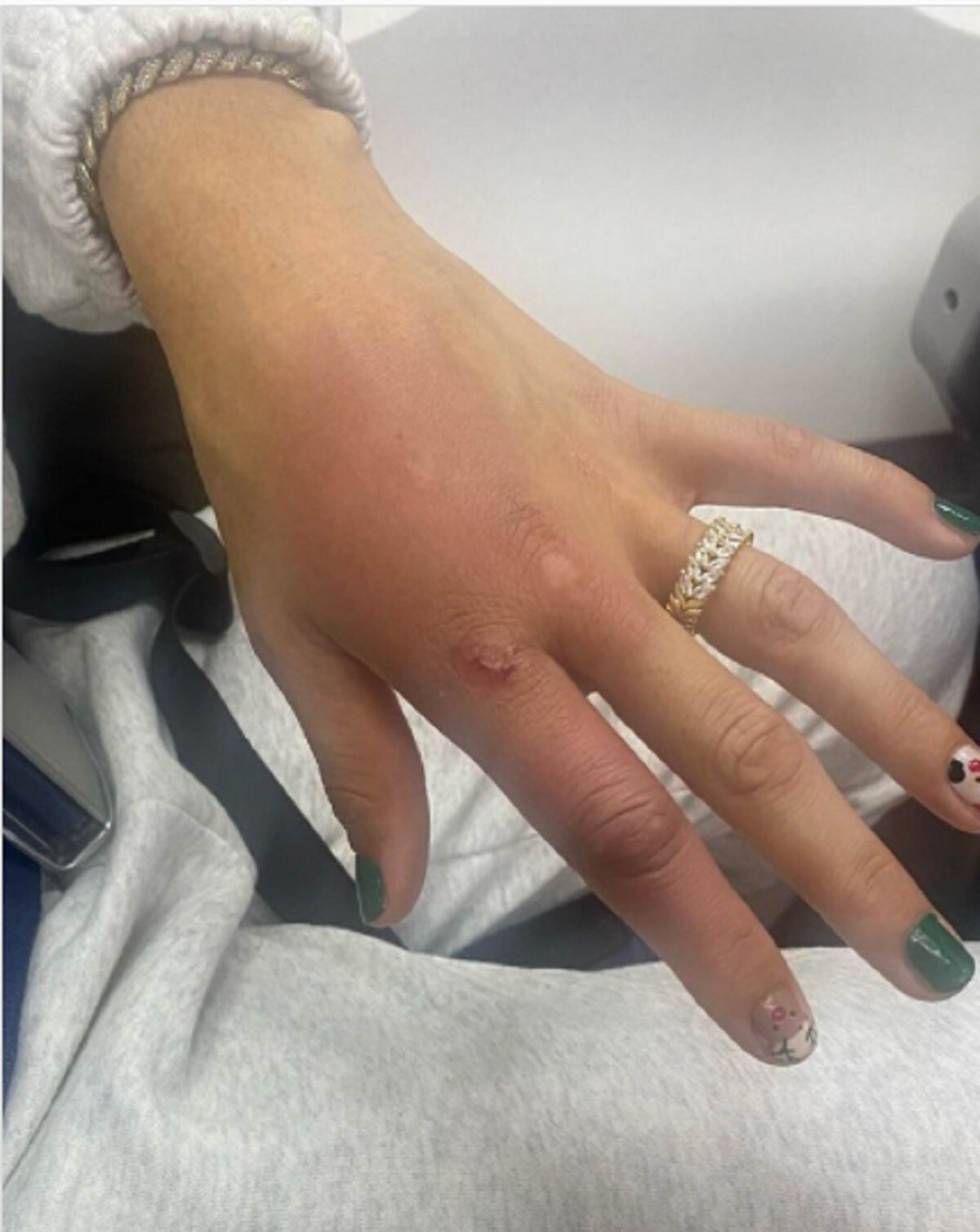  Amanda Serrano Vs Miriam Gutierrez