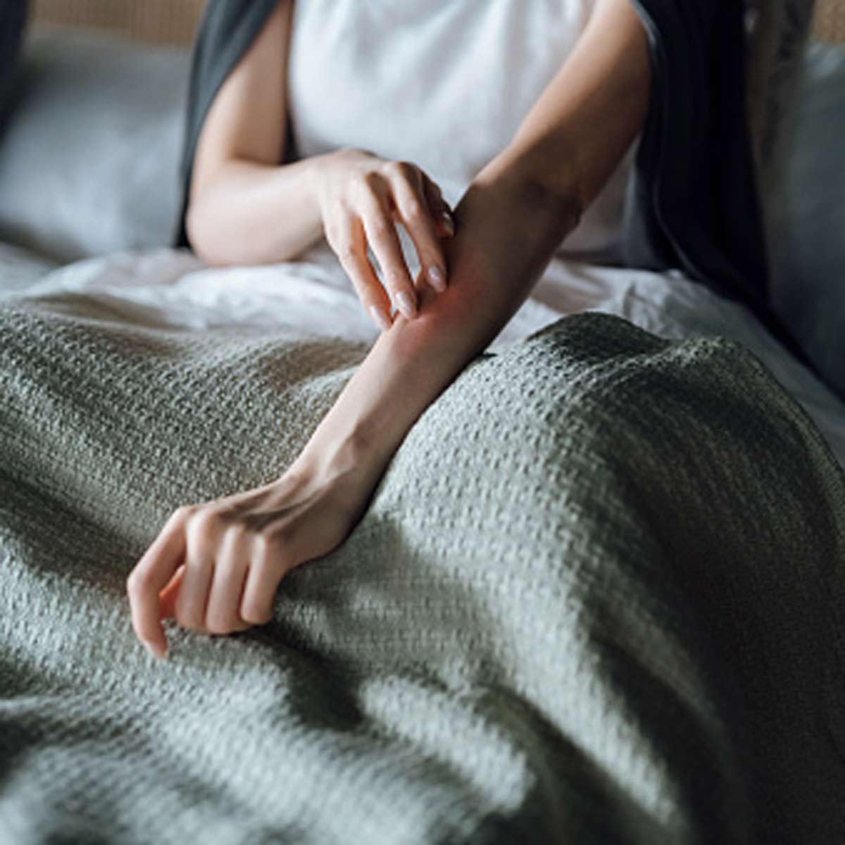 skin allergy precautions