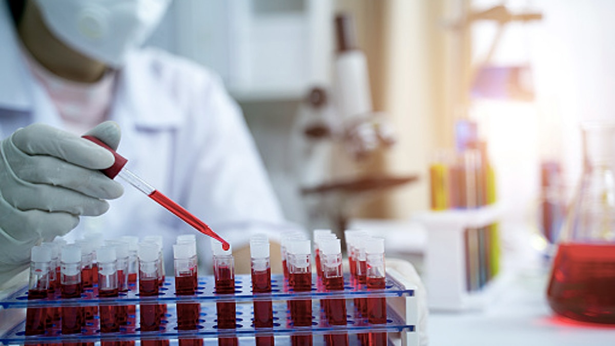 Blood test for Pregnancy complications