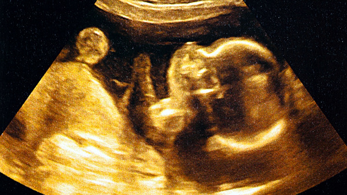 Blood test for Pregnancy complications