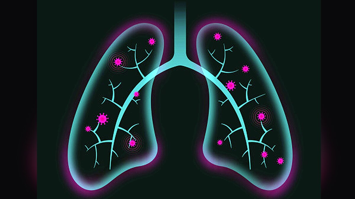 T-cell immunity against Omicron