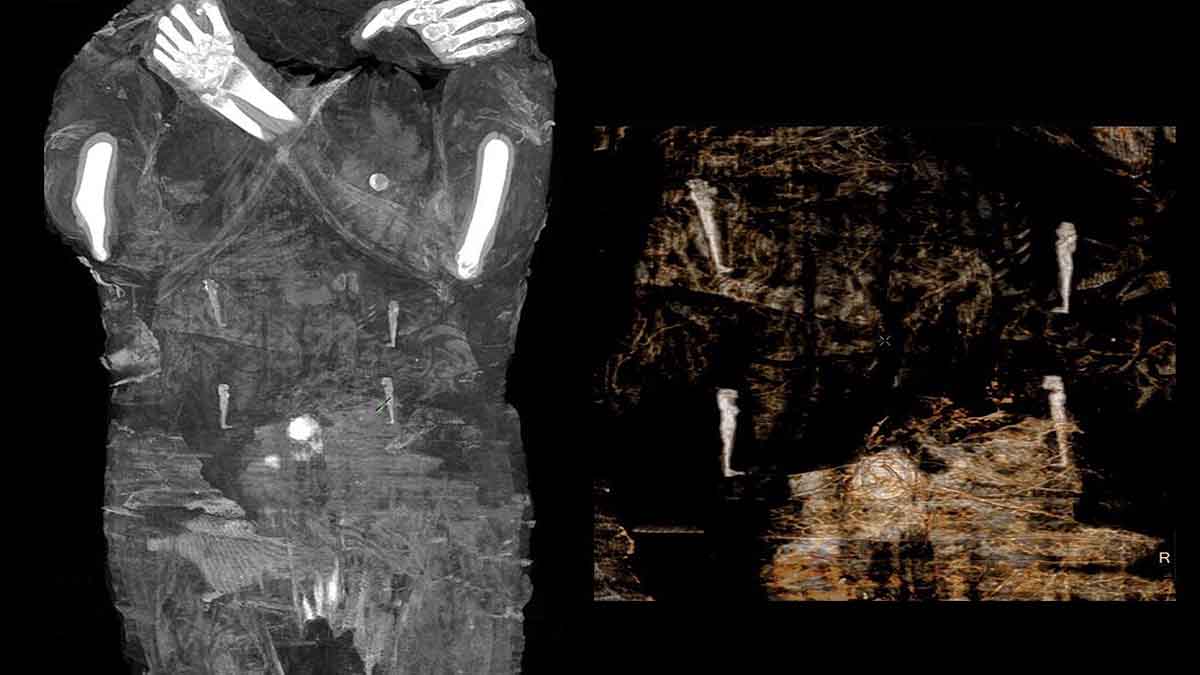 Egyptian Mummy Fetus