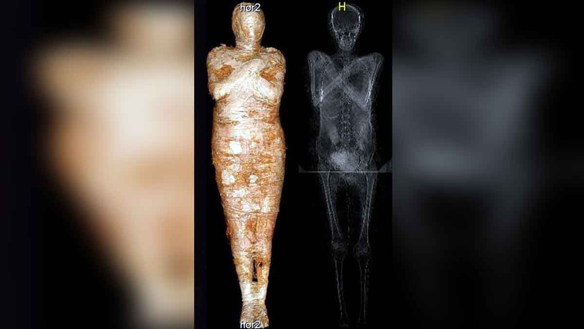 Egyptian Mummy Fetus